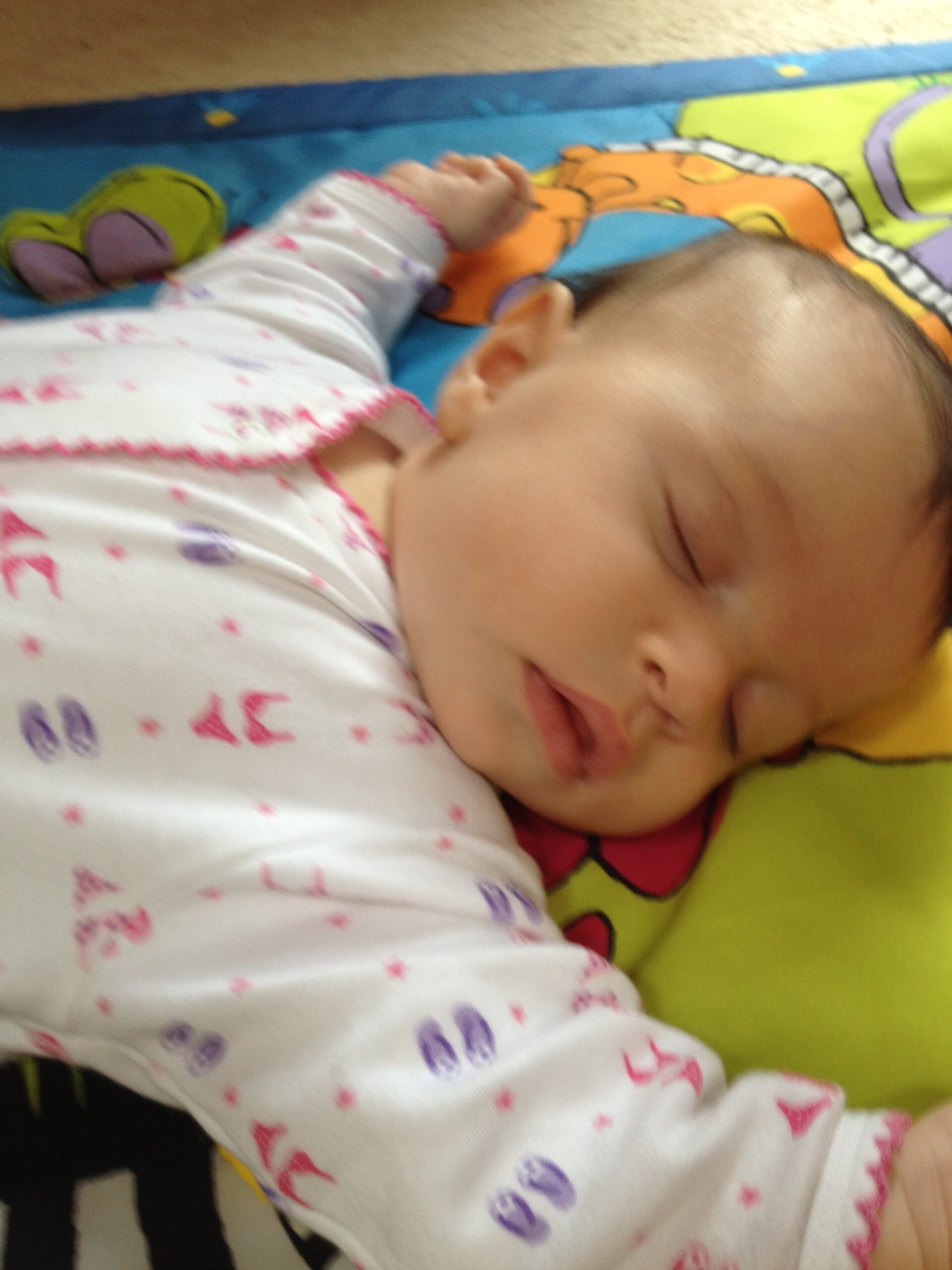 Torticollis